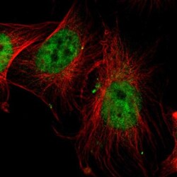SP1 Antibody, Novus Biologicals 0.1mL; Unlabeled:Antibodies, Polyclonal